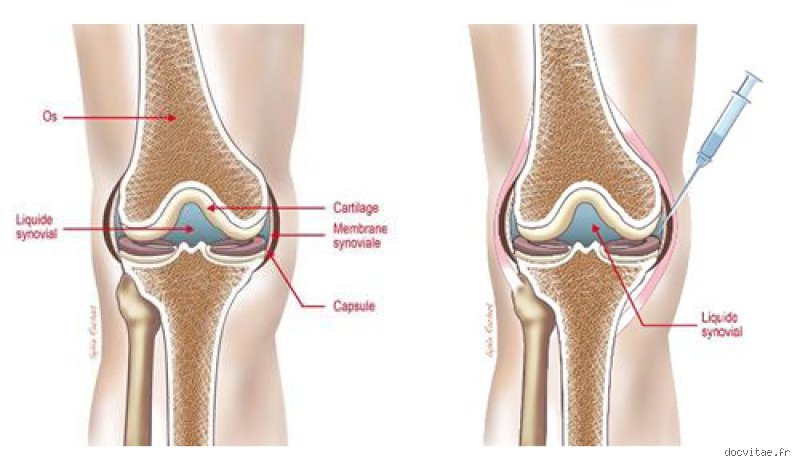 Comment puis-je lubrifier les articulations de mon genou naturellement ?