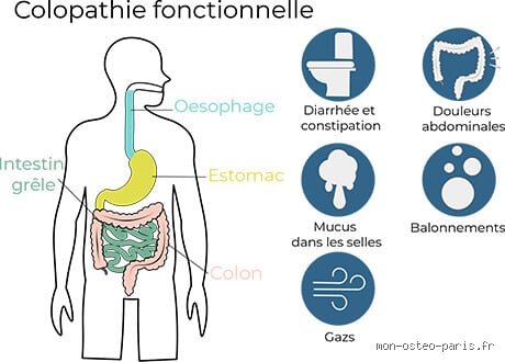 Comment savoir si mes intestins sont irrités ? Le guide complet pour décoder enfin les signaux d’alerte de votre système digestif