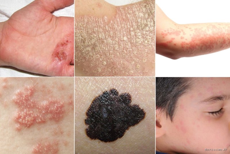 Comment savoir si mon corps est infecté ? Les signaux d'alarme que votre système immunitaire envoie pour vous alerter