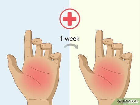Comment savoir si un nerf a été touché ? Le guide complet pour identifier les signes neurologiques et réagir à temps