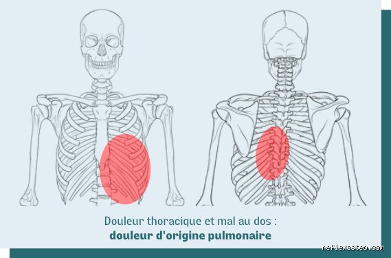 Comment savoir si une douleur thoracique provient de l'œsophage ? Le guide pour ne plus confondre reflux et alerte cardiaque