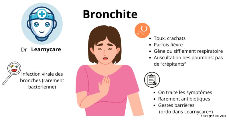 Comment savoir si une toux est virale ou bactérienne ? Le guide complet pour arrêter de s’auto-diagnostiquer à l’aveugle