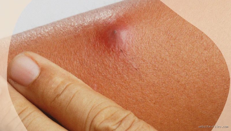 Comment savoir si vous avez une infection à l'intérieur de votre corps sans attendre l'alerte rouge des urgences ?