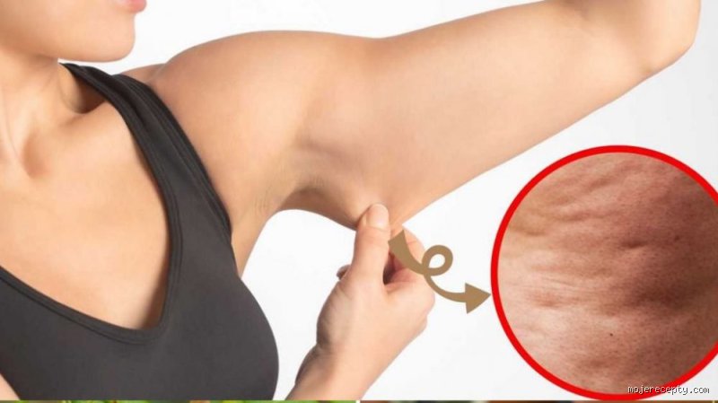 Comment se débarrasser de la cellulite sur les bras ?