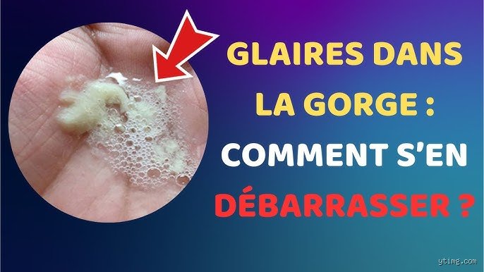 Comment se débarrasser des mucosités naturellement : le guide complet pour retrouver un souffle libre sans passer par la pharmacie