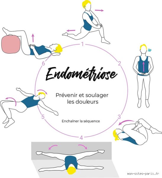 Comment soulager une grosse crise d'endométriose quand la douleur devient ingérable et que rien ne semble fonctionner ?