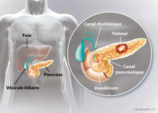 Comment vérifier l'état du pancréas ? Le guide expert pour décrypter les signaux d'une glande silencieuse mais vitale