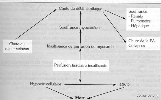 Conduite à tenir devant un sepsis : pourquoi chaque minute compte vraiment dans cette course contre la montre médicale