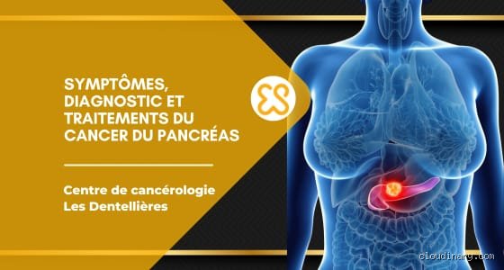 De quel côté ressent-on le cancer du pancréas ? Localisation exacte des douleurs et signes qui ne trompent pas