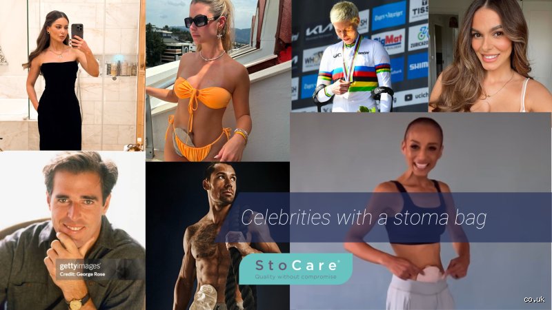 Do any celebrities have colostomy bags? Ces stars qui brisent le tabou de la stomie au grand jour