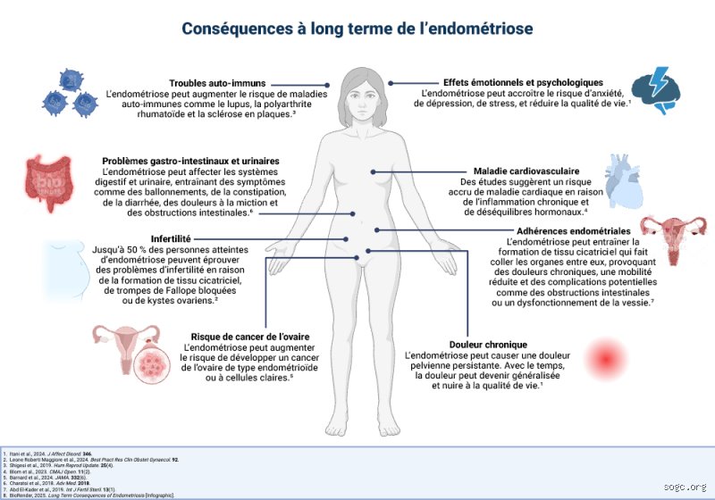 Effet de l'endométriose sur le corps : au-delà des règles douloureuses, une pathologie systémique qui redessine l'anatomie féminine