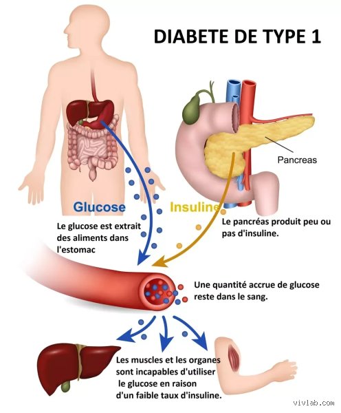 Est-ce que le diabète peut être provoqué par un choc émotionnel ? La vérité scientifique derrière un vieux mythe médical