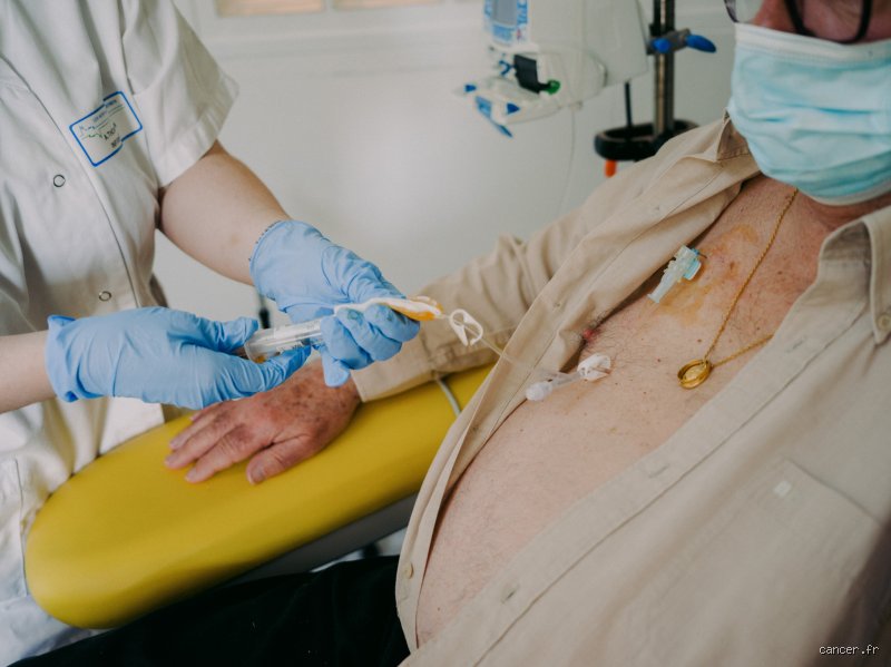 Existe-t-il une limite à la chimiothérapie ? Radiographie d’un plafond de verre médical qui bouscule l'oncologie moderne