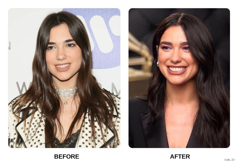 How many teeth does Dua Lipa have? Anatomie buccale d’une icône pop et réalités de l’orthodontie moderne