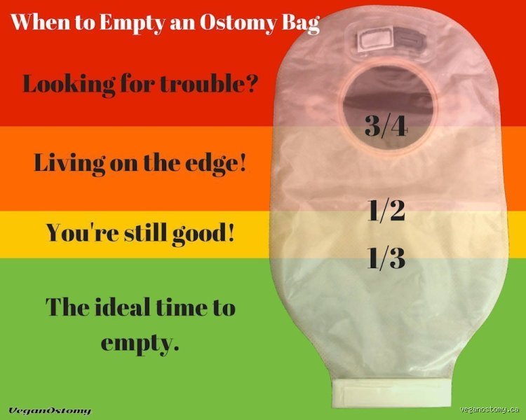 How often do you empty a stoma bag? Le guide complet pour gérer son rythme au quotidien sans stress