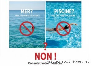 L'eau chlorée est-elle mauvaise pour les points de suture ? Ce que les chirurgiens ne vous disent pas toujours sur la baignade