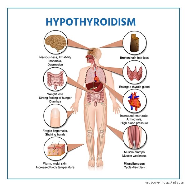 L'hypothyroïdie peut-elle provoquer des problèmes de colère ? Ce que la science cache derrière la fatigue du papillon