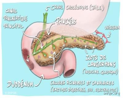 L'inflammation du pancréas peut-elle disparaître ? Comprendre les chances de guérison réelle et les risques de séquelles permanentes