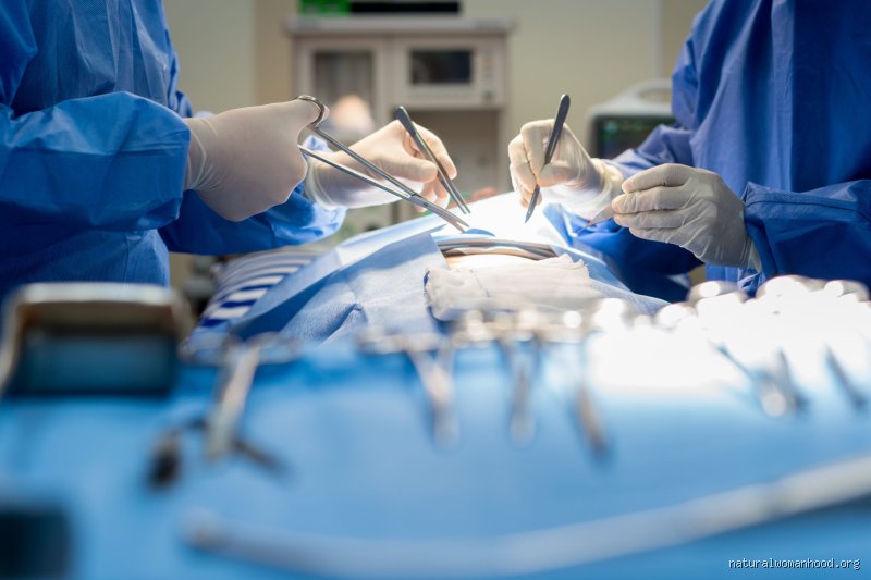 La chirurgie de l'endométriose en vaut-elle la peine ? Le dilemme entre l'espoir d'une vie sans douleur et les réalités du bloc opératoire