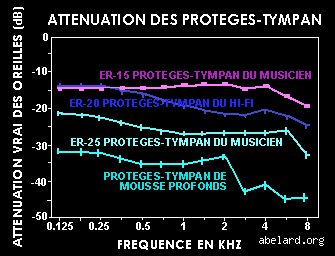 La musique forte endommage-t-elle le tympan ?