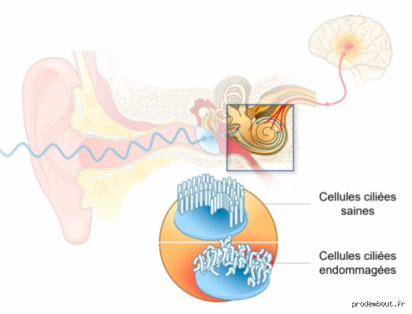 Le bruit endommagé les cellules du cerveau ? Enquête sur une agression invisible qui dépasse largement le simple inconfort auditif