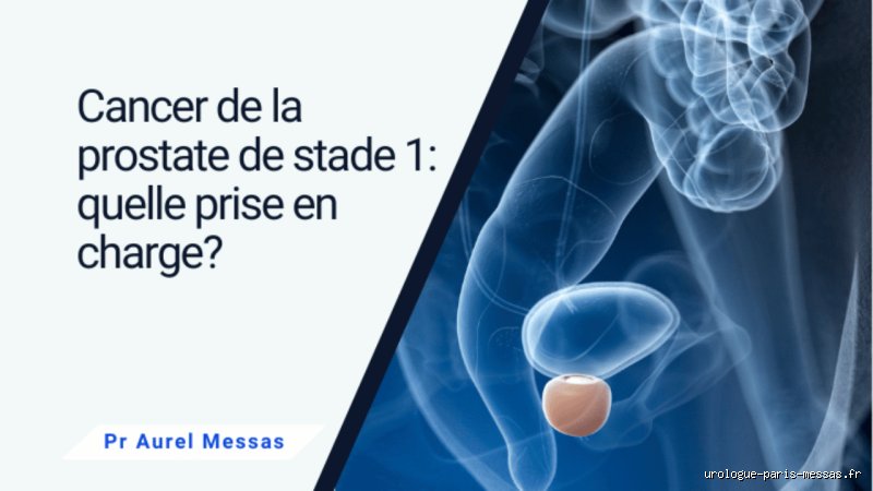 Le cancer de la prostate de stade 1 est-il guérissable ? Réalités cliniques et espoirs réels en 2026
