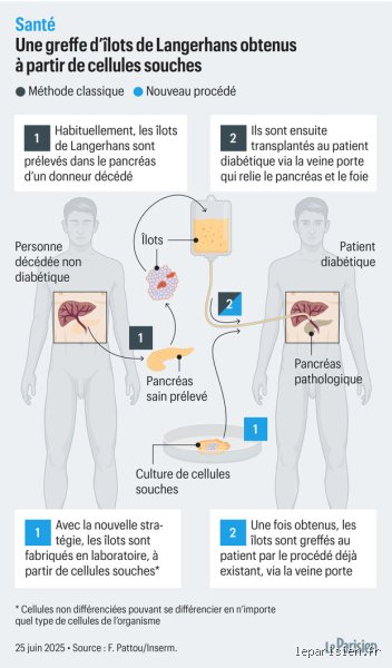Le diabète peut-il redevenir normal ? Entre espoir de rémission totale et réalité clinique, la science tranche enfin