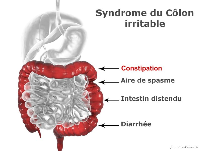 Le syndrome du côlon irritable peut-il provoquer une élévation des ALT : entre mythes digestifs et réalités hépatiques