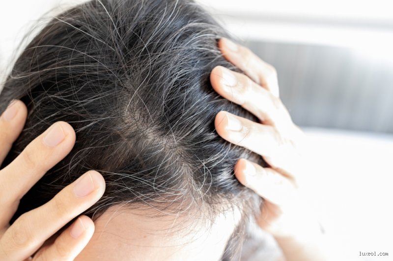 Les cheveux repoussent-ils après être tombés des racines ?