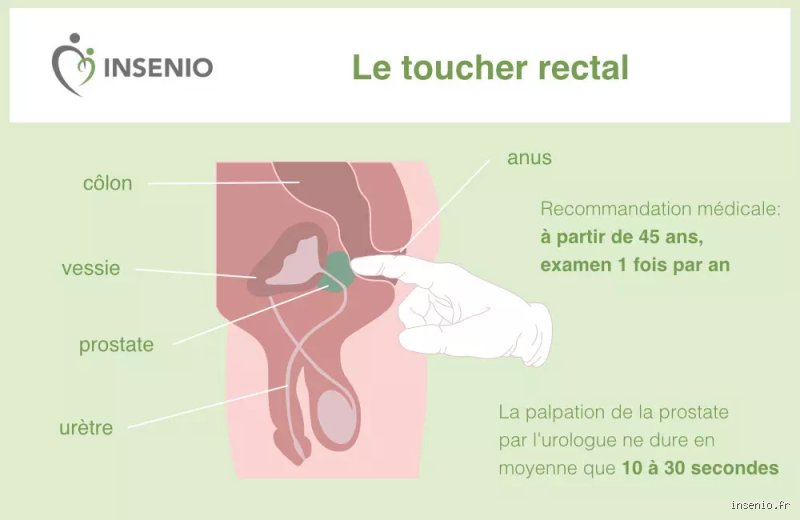 Les hommes ont-ils une érection lors d'un examen de la prostate : entre tabous médicaux et réalités physiologiques