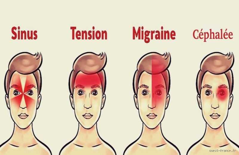 Les maux de tête chroniques sont-ils considérés comme des douleurs chroniques ? Ce que la médecine moderne change enfin à votre quotidien