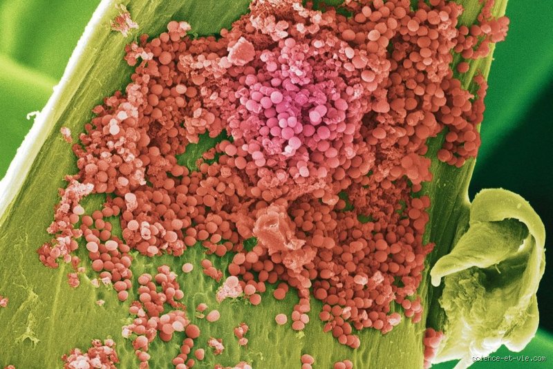 Les staphylocoques peuvent-ils vivre dans l'eau chlorée ? La vérité sur la résistance bactérienne en piscine et spa