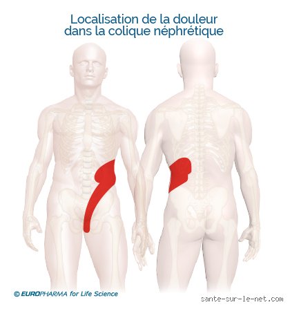 Où a-t-on mal quand on a un problème rénal ? Localisation précise et signes qui ne trompent pas