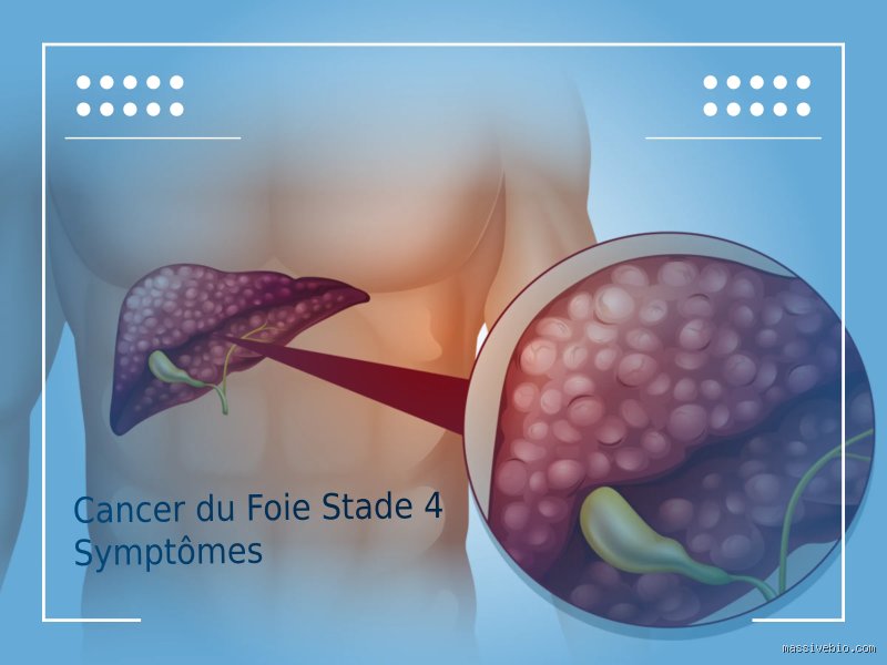 Où commence la douleur en cas de cancer du foie ? Localisation, premiers signes et réalités cliniques