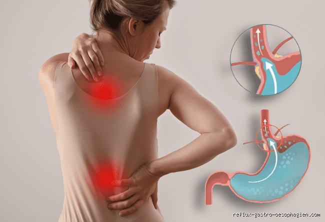Où se situe la douleur à l'œsophage ? Comprendre la topographie précise et les pièges du ressenti thoracique