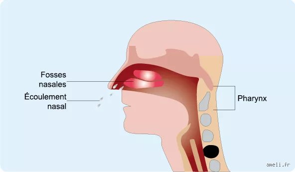 Où sort le rhume ? La vérité crue sur le voyage de l'infection hors de votre corps et les mécanismes de défense que l'on ignore trop souvent