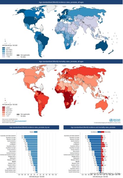 Où y a-t-il le plus de cancer de la prostate ? Analyse géographique d'une pathologie qui redessine la carte mondiale de la santé masculine