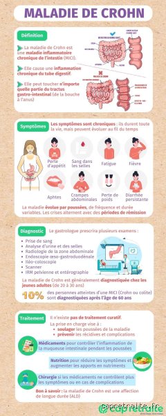 Peut-on souffrir à la fois du syndrome de l'intestin irritable et de la maladie de Crohn : la double peine digestive expliquée