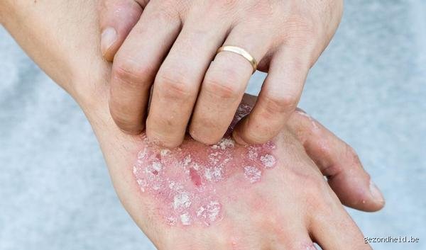Peut-on tomber malade en allant à la piscine ? Enquête sur les risques réels derrière l'odeur de chlore
