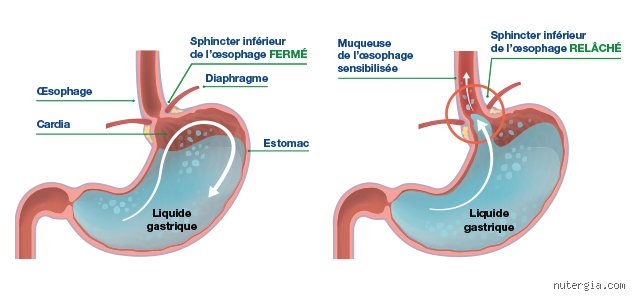 Pourquoi a-t-on trop d'acidité dans le corps ? La vérité sur un déséquilibre moderne caché et ses véritables coupables