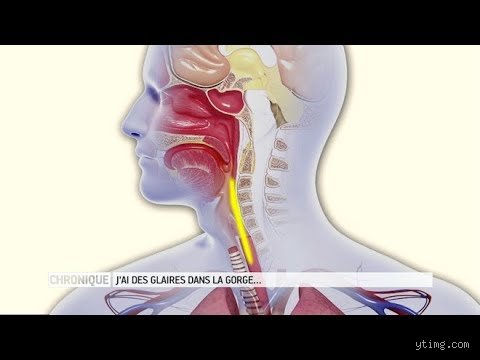 Pourquoi ai-je toujours du mucus dans l'arrière-gorge : comprendre enfin ce jetage postérieur qui vous gâche la vie