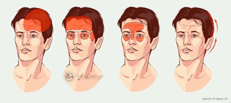 Pourquoi ai-je toujours mal à la tête tous les jours ? Enquête sur un enfer quotidien et invisible