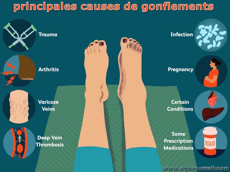 Pourquoi ça gonfle ?