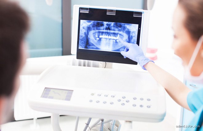 Pourquoi faire une radiographie dentaire ?