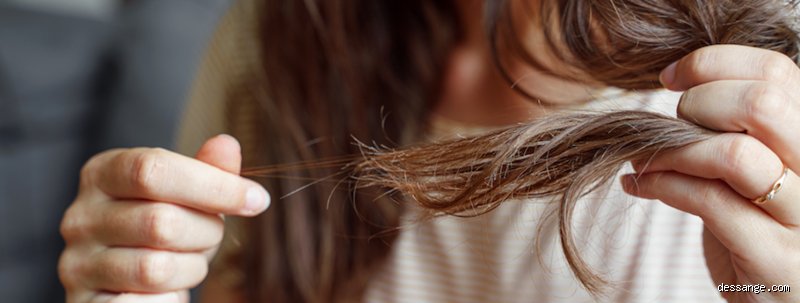 Pourquoi je perds beaucoup de cheveux : Les causes que l'on explore rarement