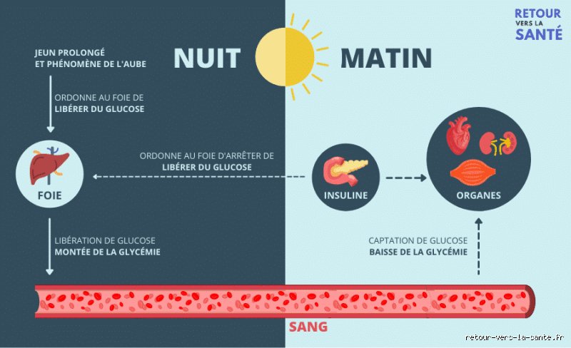 Pourquoi la glycémie est-elle élevée le matin ? Comprendre enfin le phénomène de l'aube et l'effet Somogyi