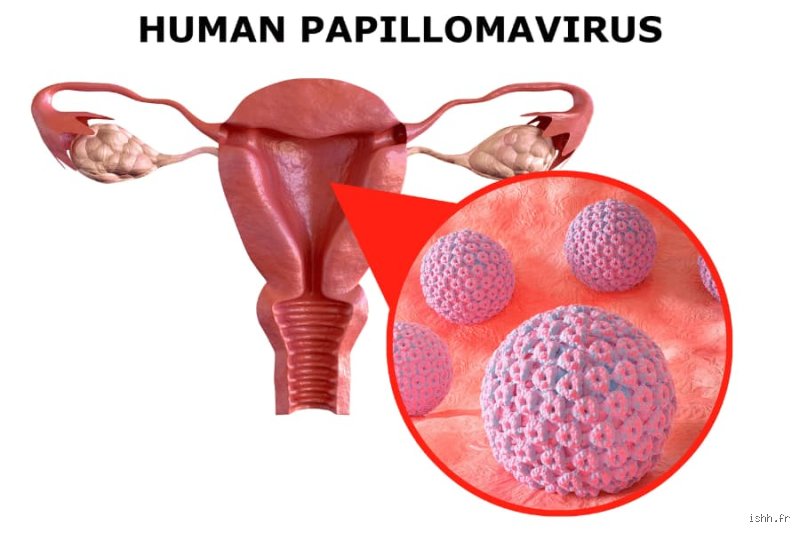 Qu'est-ce qu'une infection cancéreuse et comment certains virus peuvent-ils réellement déclencher des tumeurs ?