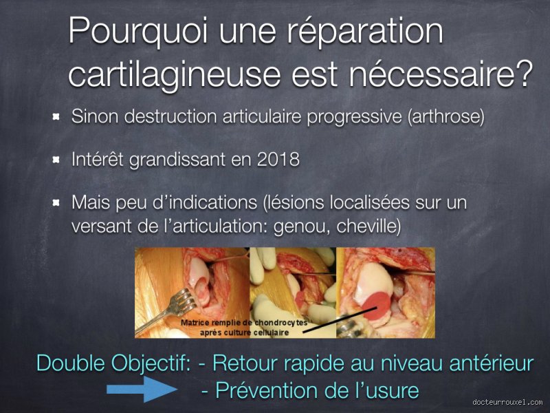 Qu’est-ce qui peut stimuler la réparation du cartilage ? Entre promesses biotechnologiques et réalités biologiques complexes