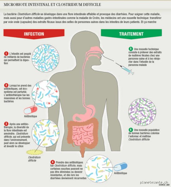Le grand nettoyage interne : qu’est-ce qui tue les bactéries dans l’intestin et pourquoi votre microbiote est en état de siège permanent ?