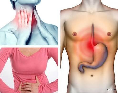 Douleur à l'œsophage : quand faut-il vraiment commencer à s'inquiéter pour sa santé digestive ?